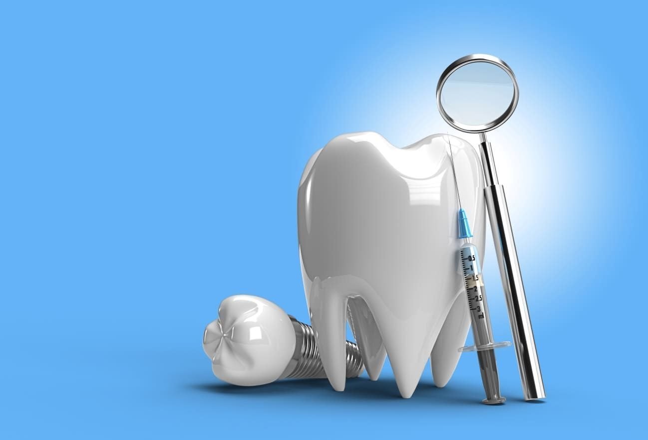 Dental Implants Image